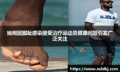 姚明因脚趾感染接受治疗运动员健康问题引发广泛关注